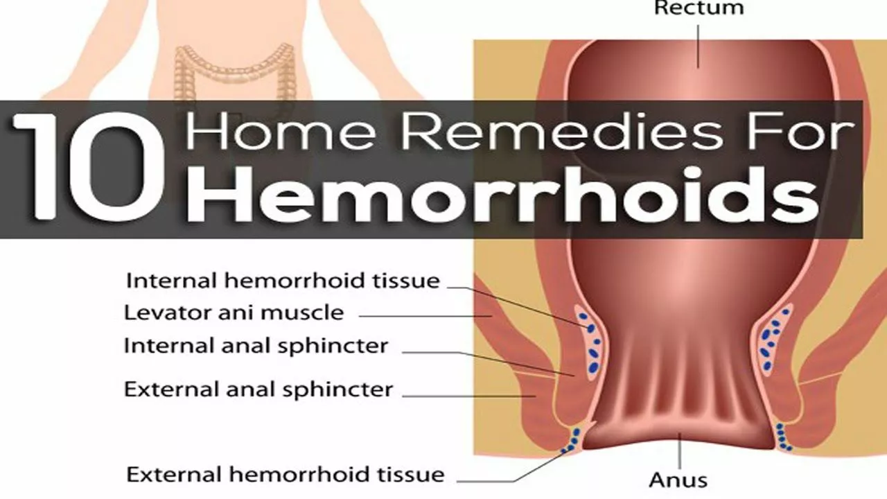 The Effectiveness of Prilocaine in Treating Hemorrhoids